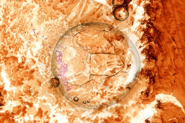 hill-with-eye-detail-130D2C335-4AA3-B70A-BEDC-2449E13CA6FA.jpg
